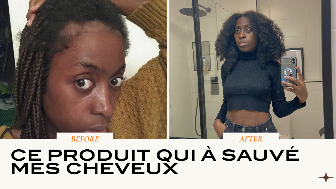 Charger la vidéo : Pierre jaune dermatite séborrhéique